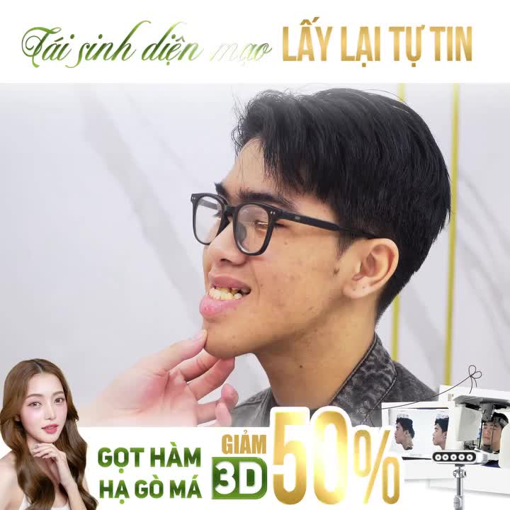 TRẢI NGHIỆM FACE SCAN 3D ĐỈNH CAO, TẬN HƯỞNG ƯU ĐÃI 50%