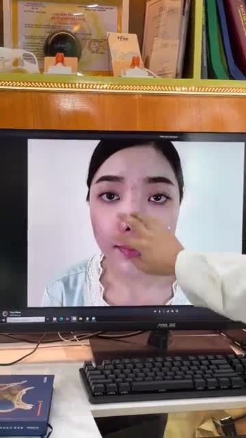 HÀNH TRÌNH GIẢI CỨU MŨI SAU 3 NĂM CỦA PHƯƠNG ĐÔNG