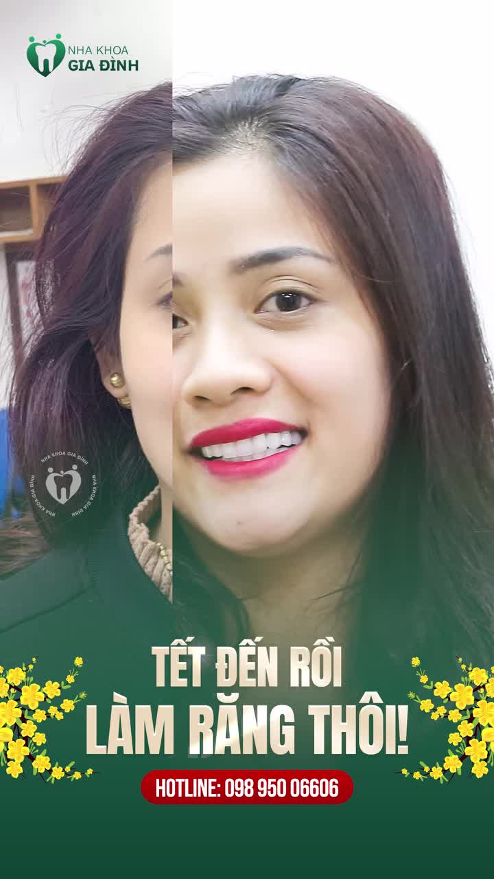RĂNG TRẮNG BẬT TONE - SÁNG BỪNG NGÀY TẾT TẾT SÁT BÊN RỒI TÂN TRANG NỤ CƯỜI NGAY THÔI!!