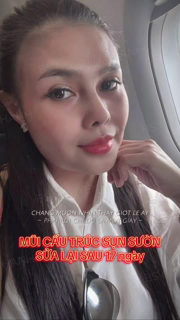 Dưới ánh sáng cửa sổ máy bay, sóng mũi mới vào dáng nhìn mà mê luôn - gọn, thon, đường cong mượt thấy rõ từng góc nghiêng.
