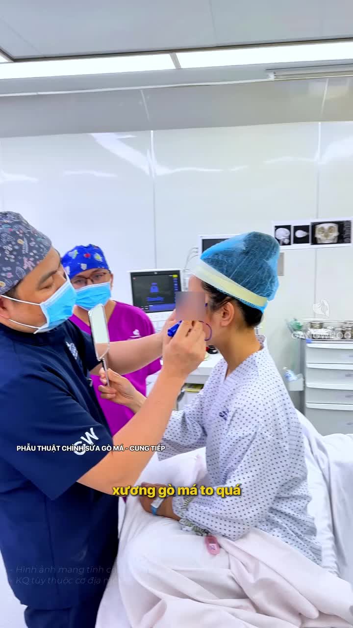 Hạ gò má – tinh chỉnh lại tỷ lệ, không làm mất nét riêng