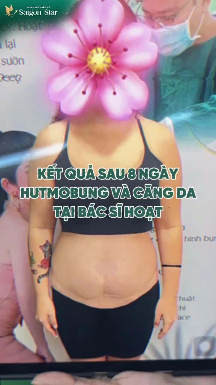 KẾT QUẢ 8 NGÀY ĐỘ DÁNG CÙNG SIÊU COMBO: