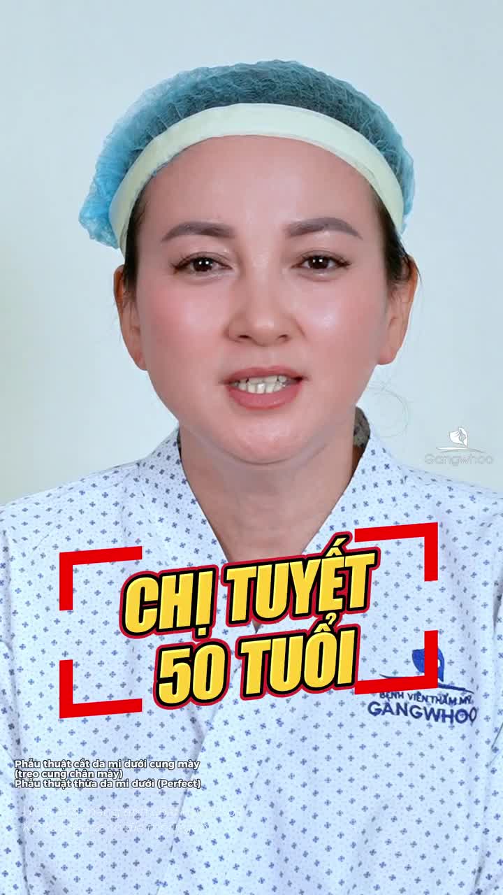 Treo cung chân mày cắt mí dưới