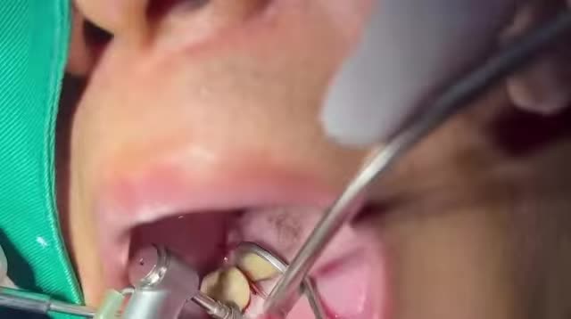 Đầu xuôi đuôi lọt! Bác sĩ vẫn chăm chỉ cấy và chờ ngày gặt