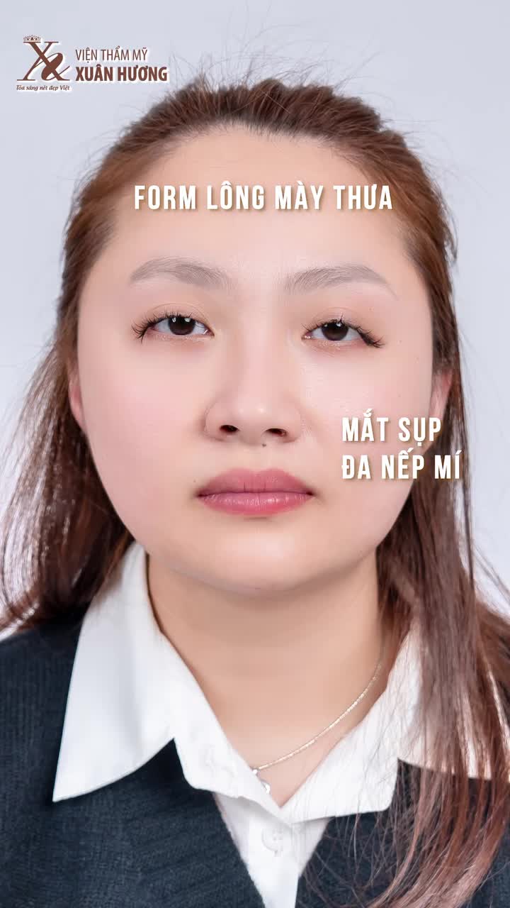 CHẤN ĐỘNG: COMBO ĐIÊU KHẮC MÀY + CẮT MÍ TRÊN ĐẸP NGAY SAU LÀM LÀ CÓ THẬT?