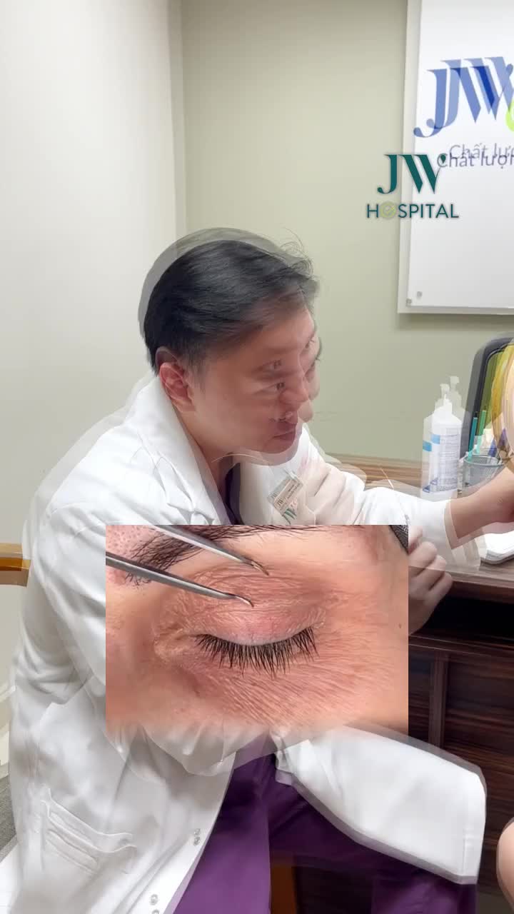 90% SỤP MÍ CẢI THIỆN RÕ SAU KHI XÁC ĐỊNH ĐÚNG NGUYÊN NHÂN