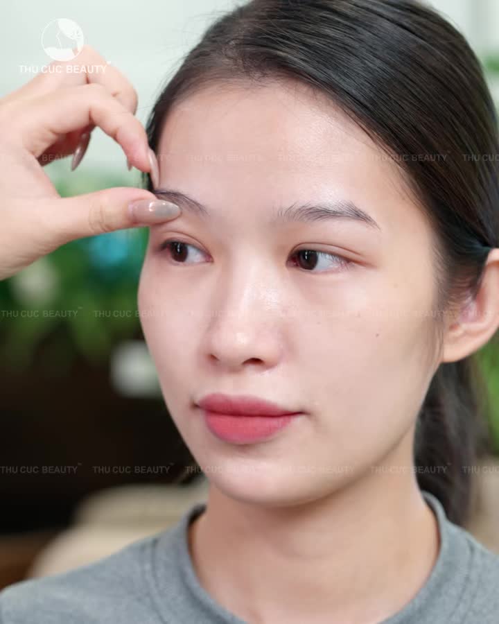 Từ mí sụp, mí lệch → ánh nhìn tươi tắn hơn