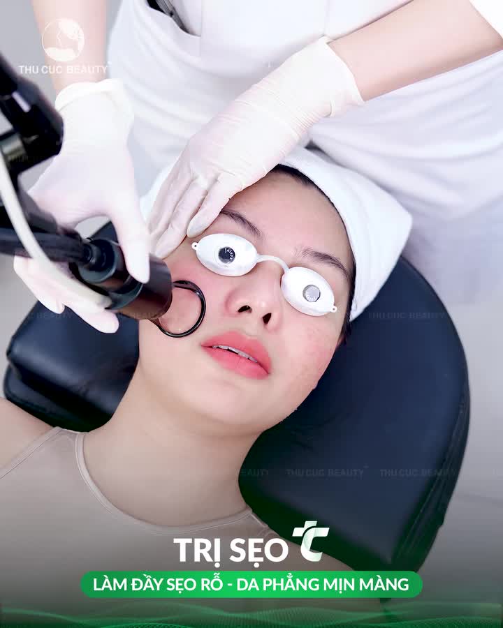 SẸO RỖ CÀNG THÊM RỖ KHI ĐIỀU TRỊ SAI!