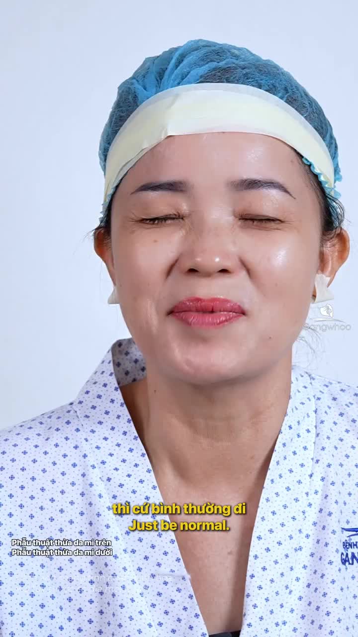 Lấy lại vẻ đẹp trẻ trung trên đôi mắt với COMBO cắt mí trên và mí dưới được khách hàng lựa chọn.