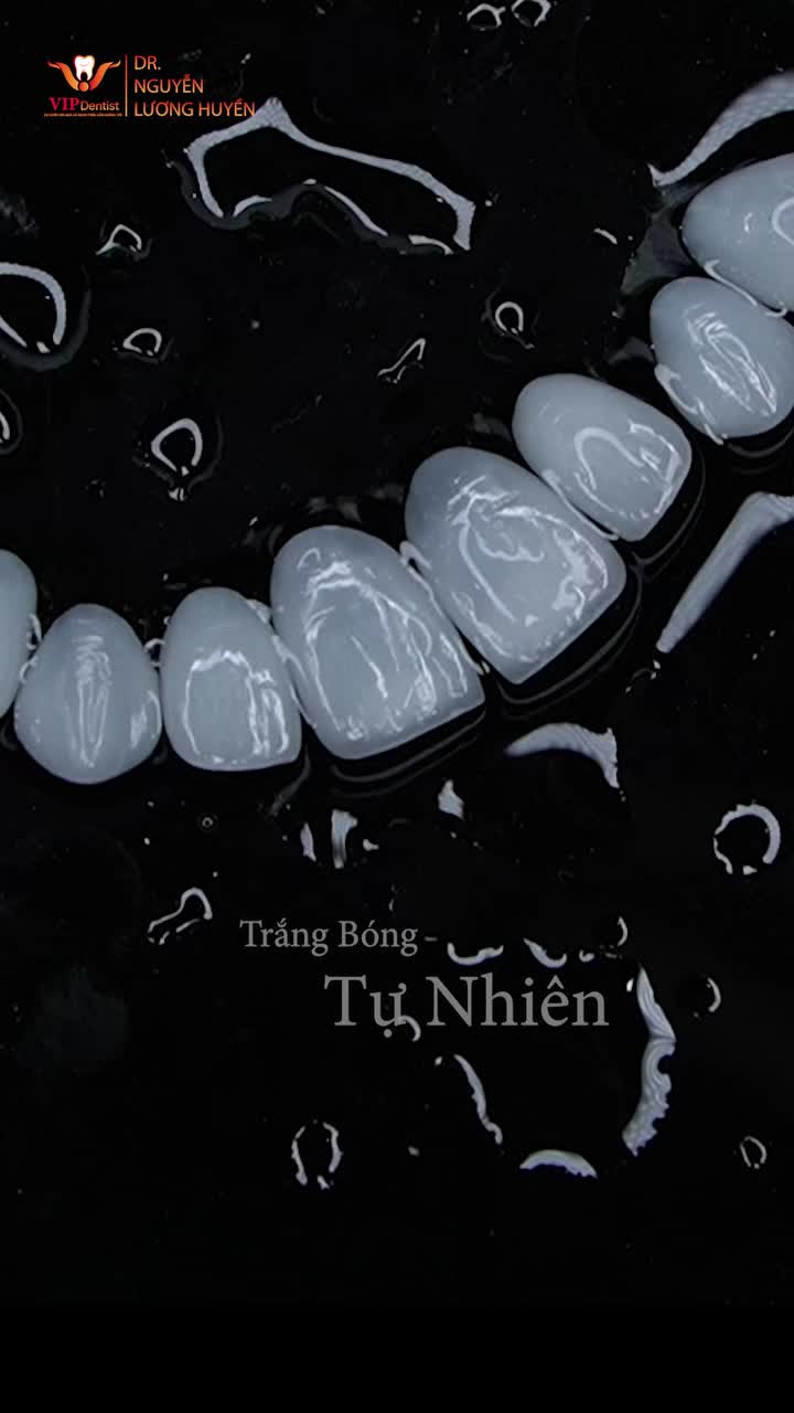 Răng sứ HT Smile - Cho nụ cười bền đẹp vĩnh cửu