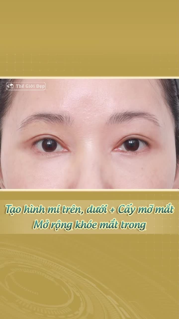 Giải pháp tái cấu trúc toàn diện vùng mắt