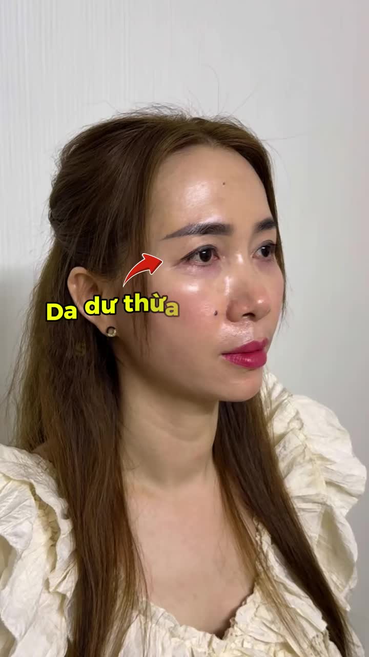 COMBO "HACK" TUỔI THẦN SẦU: NÂNG CUNG MÀY + THU CÁNH MŨI