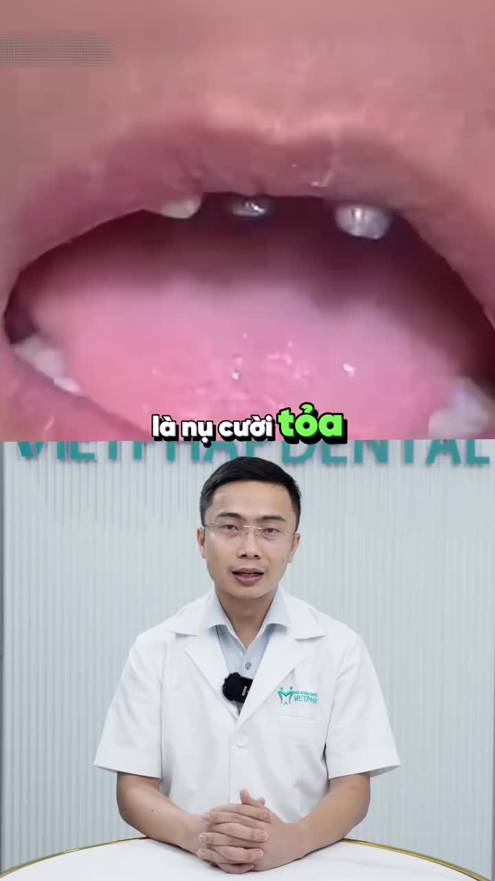 CÁI GIÁ PHẢI TRẢ KHI CHỌN RĂNG SỨ GIÁ RẺ