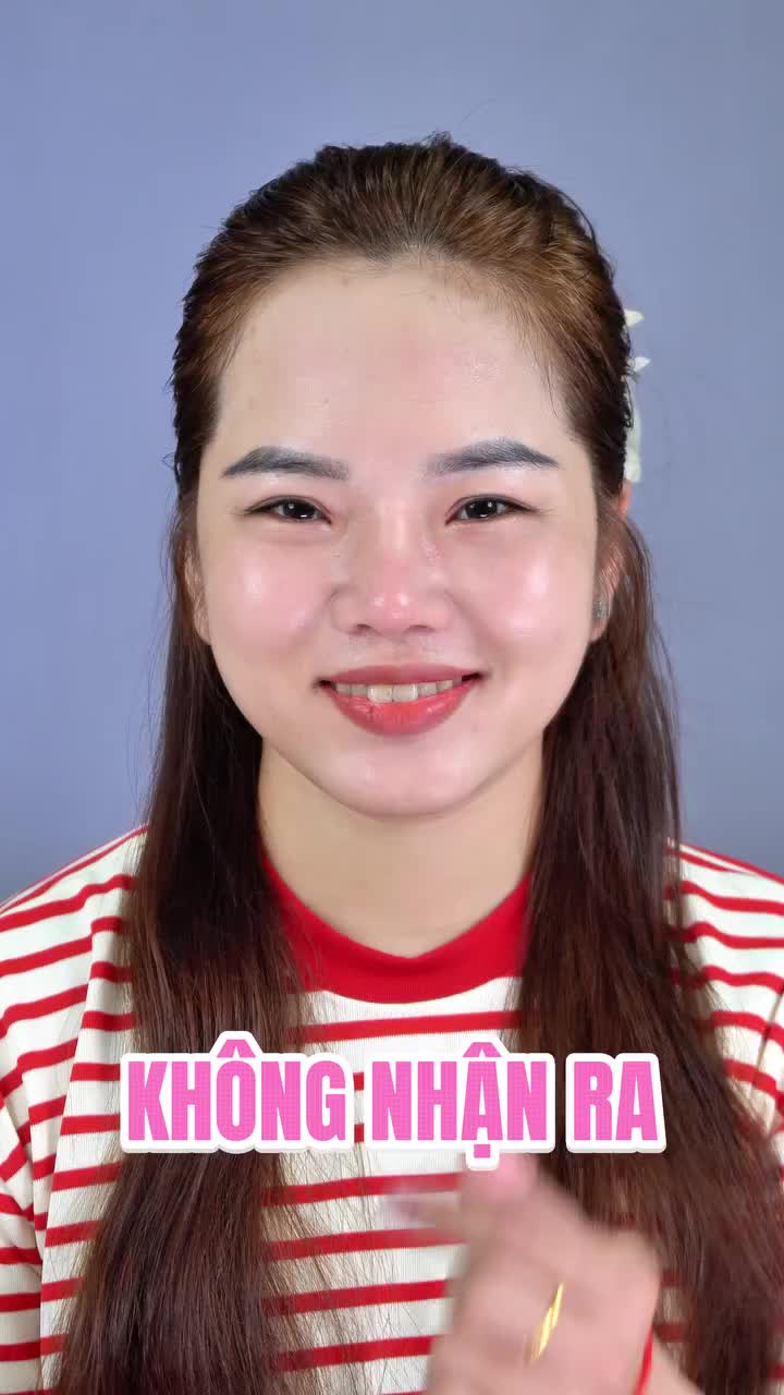 FEEDBACK DÁNG MŨI SAU 10 NGÀY NÂNG TẠI TUẤN LINH!!