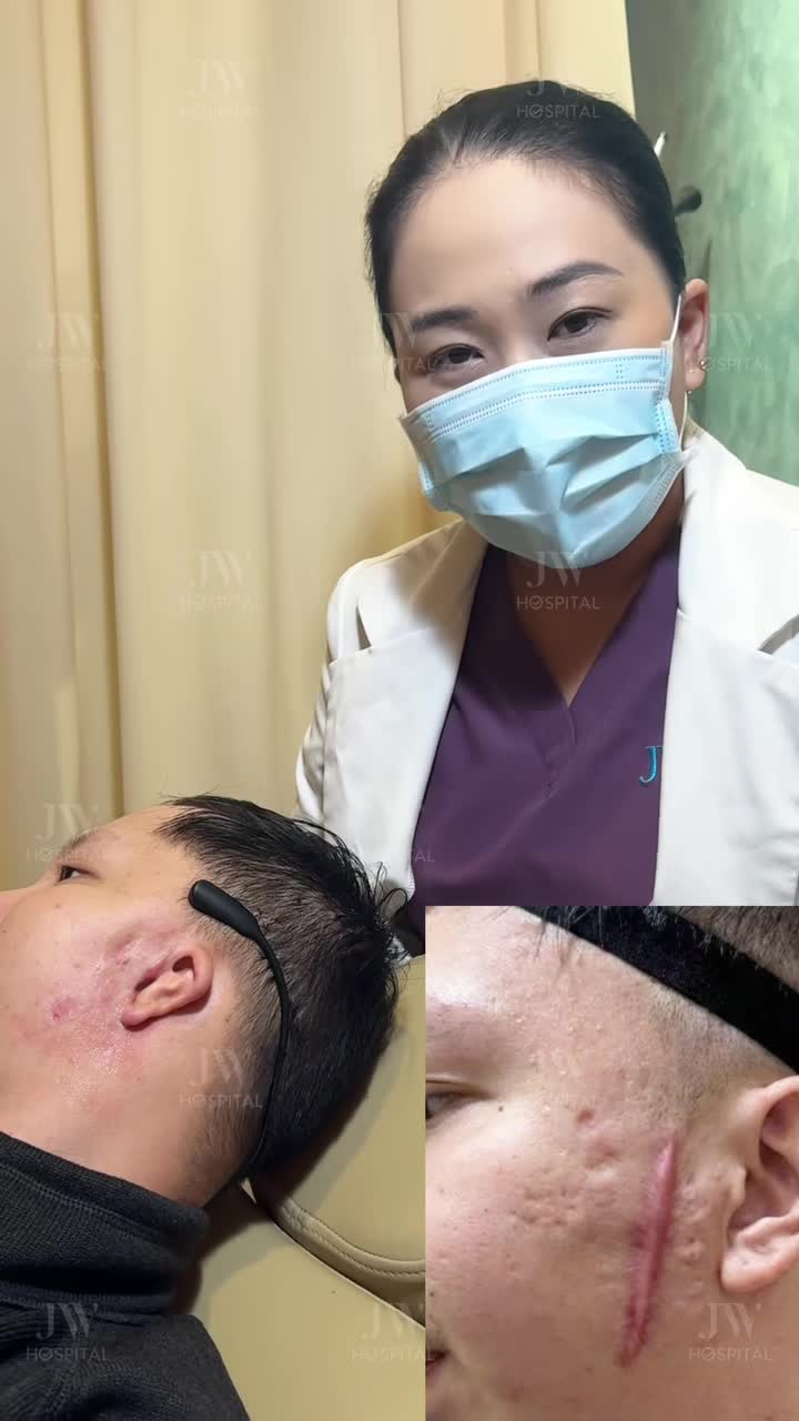 XOÁ 90% SẸO XẤU LỒI LÕM - BÁC SĨ JW CHỈ RA PHÁC ĐỒ ĐIỀU TRỊ CHUẨN Y KHOA