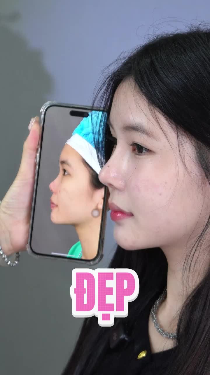 ĐẸP THANH TÚ NHỜ DÁNG MŨI CAO HÀI HÒA!!