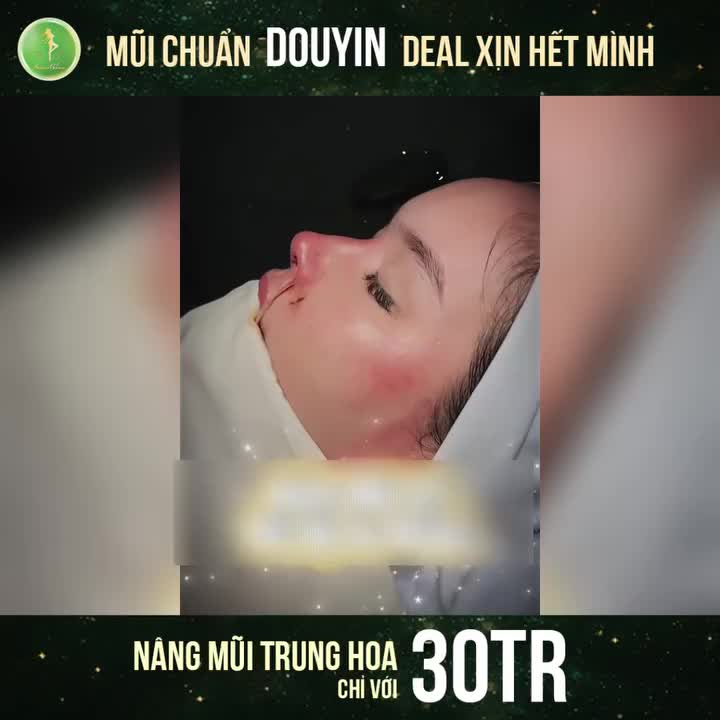 CẬP NHẬT DÁNG MŨI HOT TREND NHẤT 2026 - NÂNG MŨI TRUNG HOA CHỈ 30TR