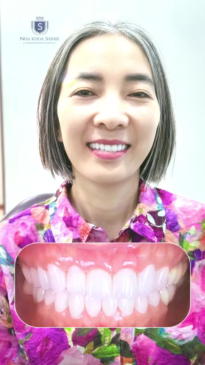 HẠNH PHÚC VỠ ÒA TÌM LẠI ĐƯỢC NỤ CƯỜI SAU NHIỀU NĂM CHỊU ĐỰNG HÀM RĂNG HỎNG