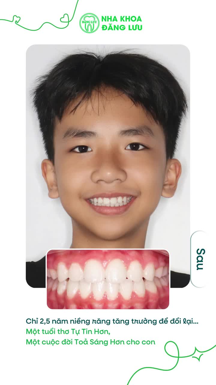 Đầu tư sự tự tin cho con ngay từ việc thay đổi Nụ Cười