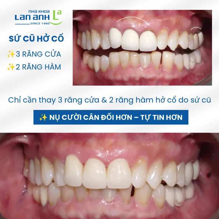 Một nụ cười đẹp không cần quá nhiều thay đổi.