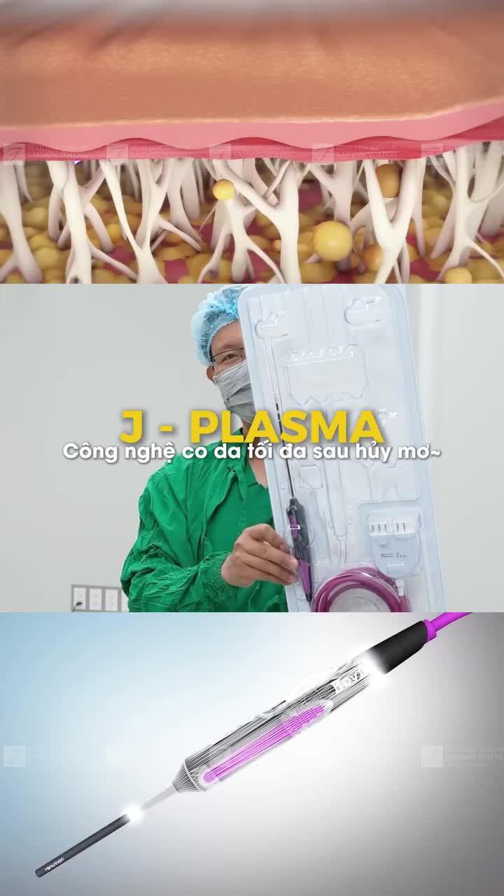 Nhìn vóc dáng thay đổi trong video là đủ hiểu vì sao hội chị em lại mê mẩn dịch vụ này đến vậy.