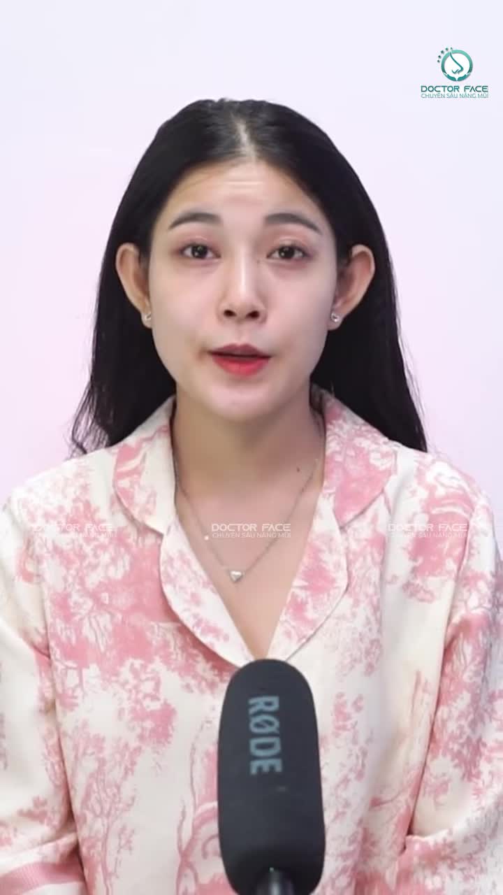 Từng cấy chỉ mũi rồi quyết định nâng mũi, sau hơn 5 tháng bạn ấy có những cảm nhận như thế nào về lựa chọn này?