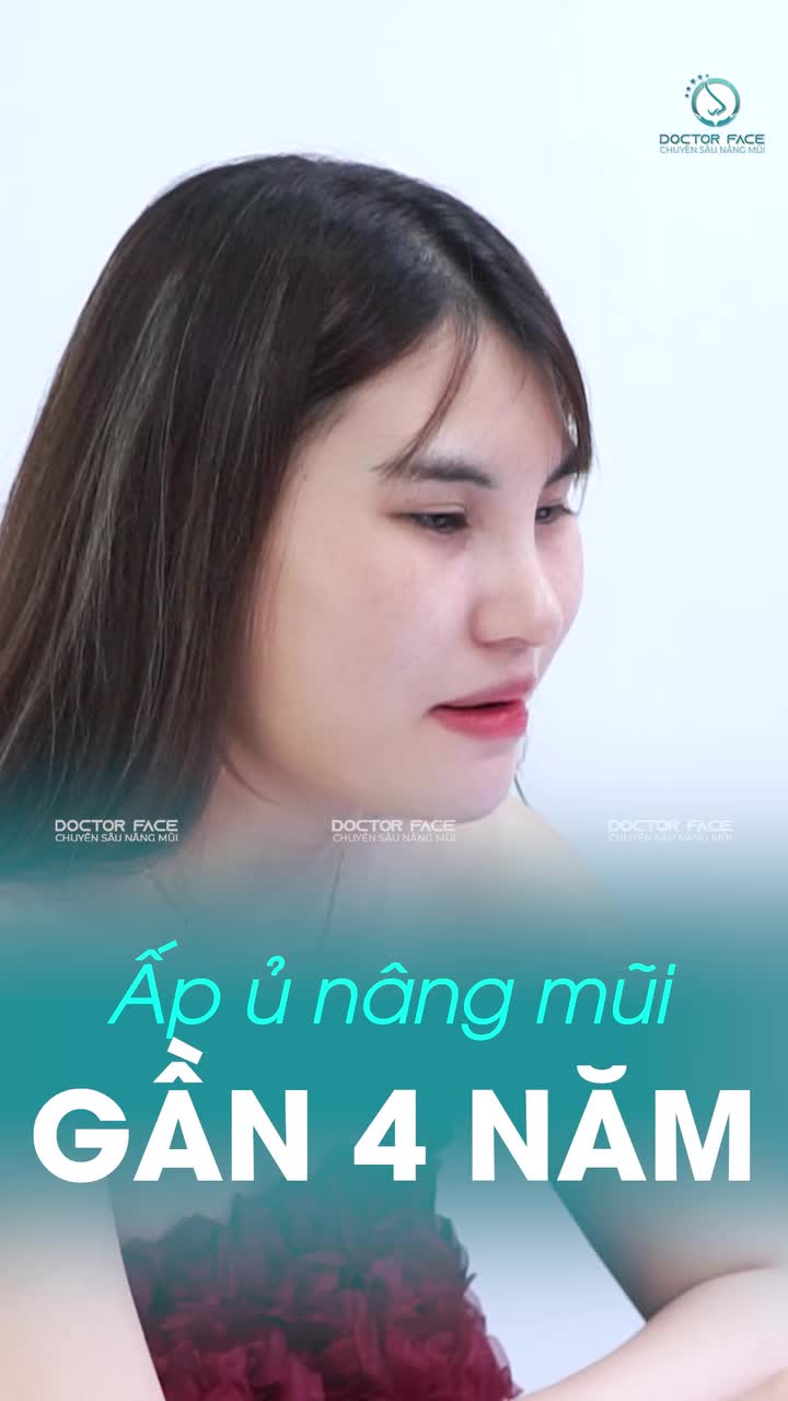 Chuẩn bị cho ngày cưới, chị khách này quyết định nâng mũi sau một lời động viên rất dễ thương từ chồng tương lai