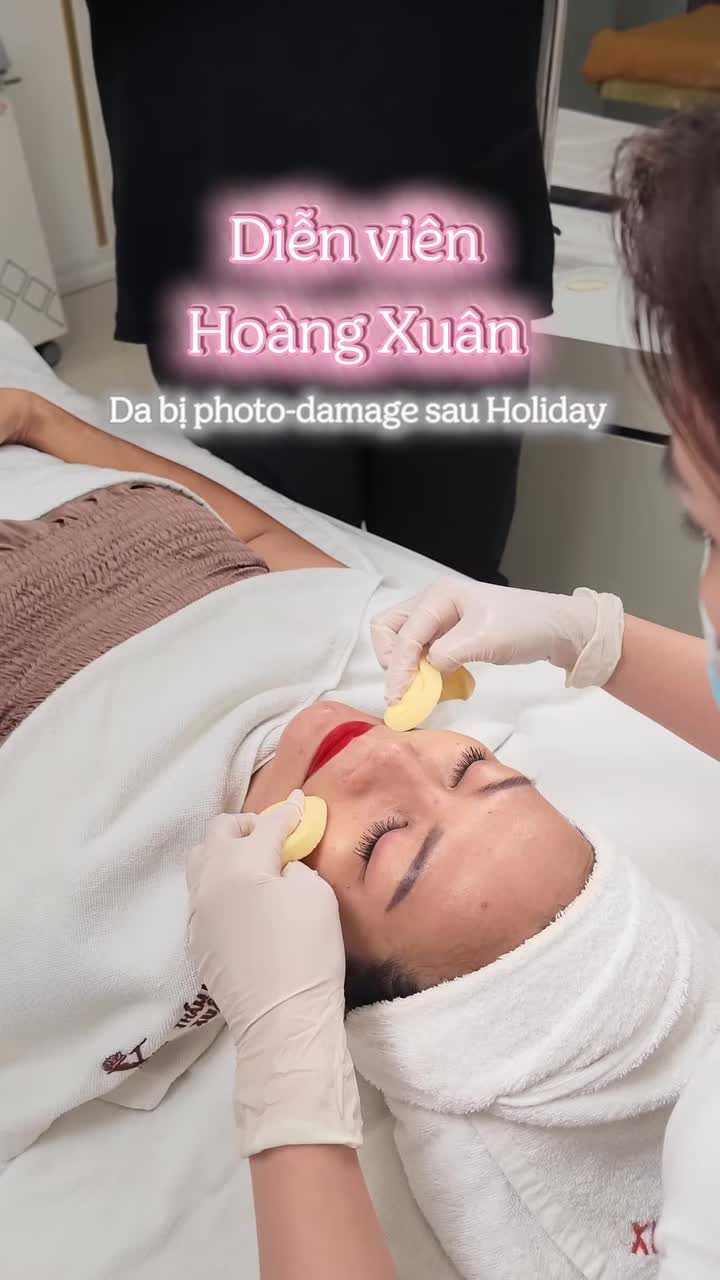 DIỄN VIÊN HOÀNG XUÂN VÀ HÀNH TRÌNH "GIẢI CỨU" LÀN DA BỊ BỎNG NẮNG
