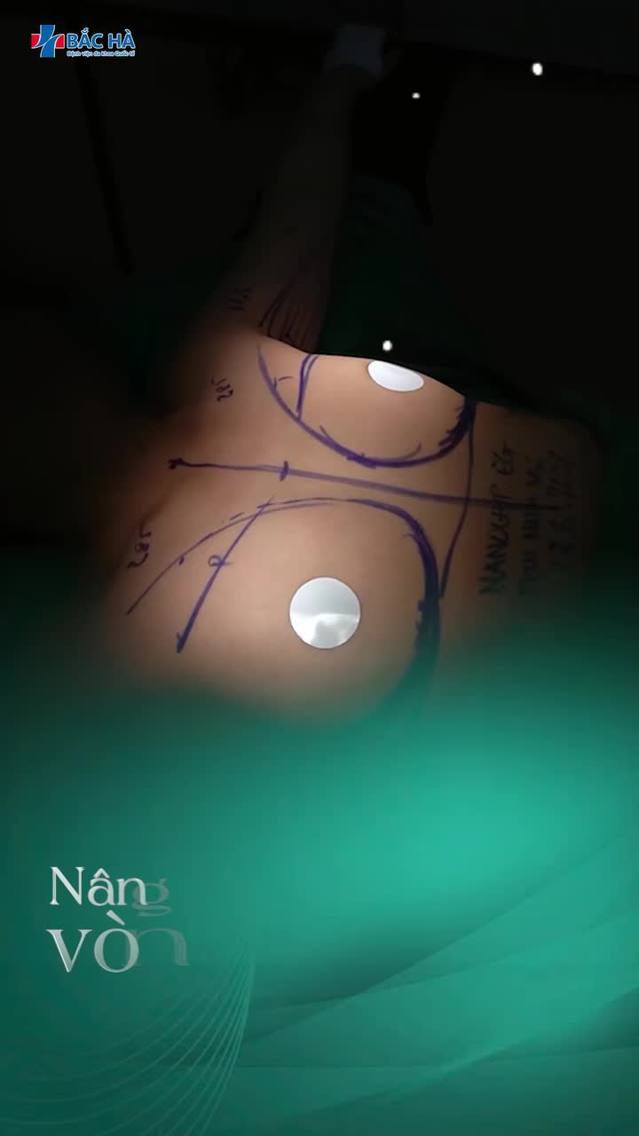 TÁI KHÁM SAU NÂNG NGỰC, KHÁCH HÀNG NÓI GÌ MÀ AI CŨNG MUỐN NGHE?