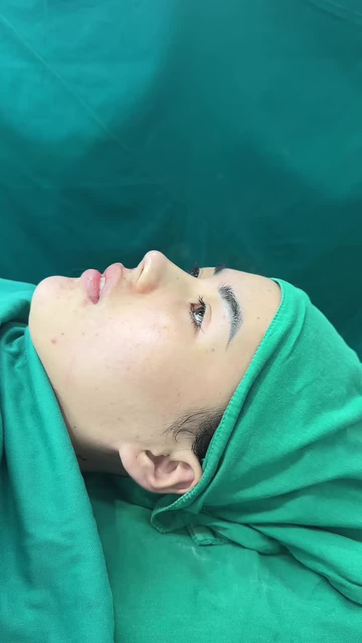 Mũi bọc sụn sau phẫu thuật