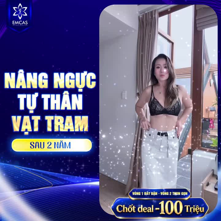 Kết quả sau 2 năm Nâng ngực tự thân chuyển vạt TRAM