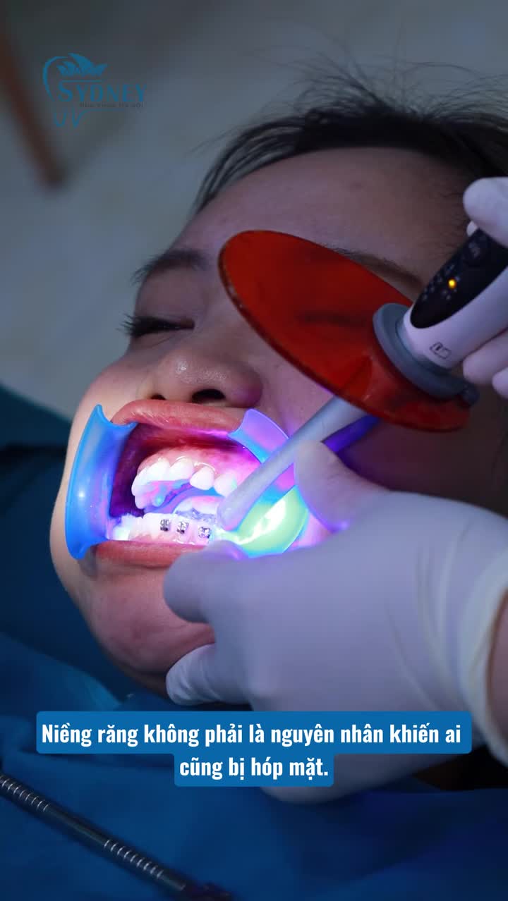 Hóp mặt sau niềng răng - Đừng vội đổ lỗi cho chỉnh nha