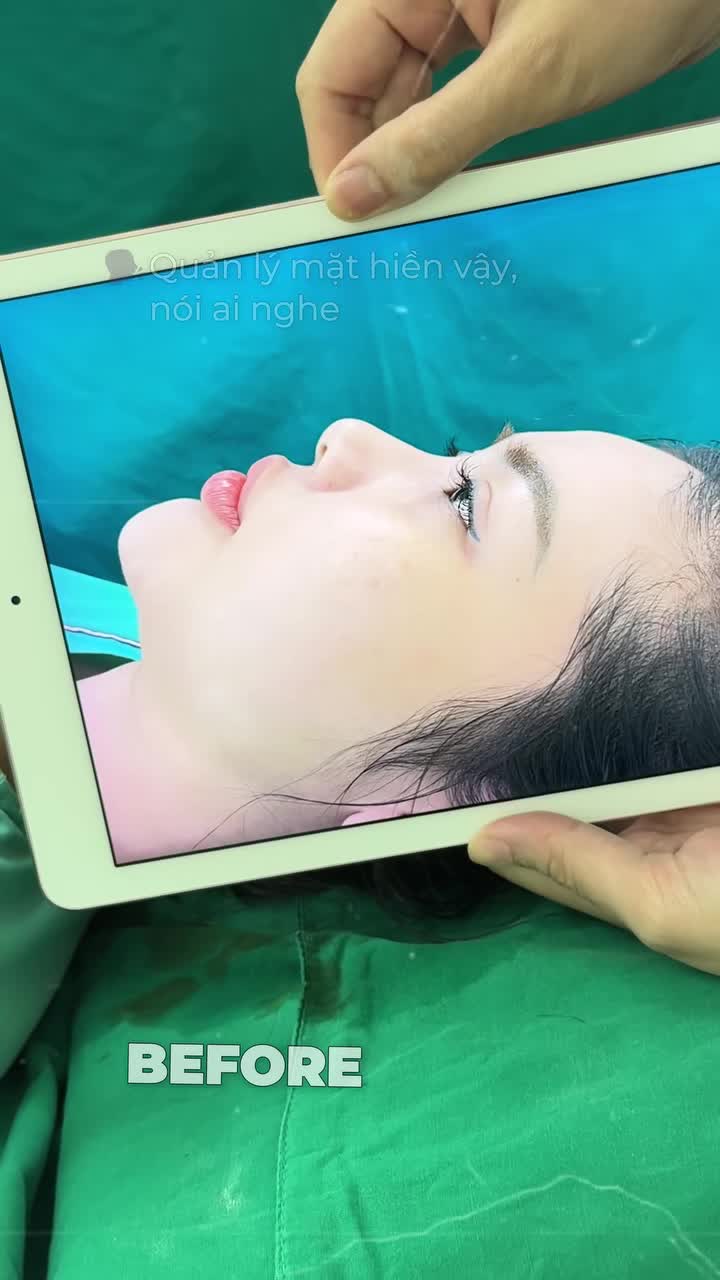 THẦN THÁI, ĐẸP SẮC NÉT NHỜ DÁNG MŨI CAO SANG PHÙ HỢP!