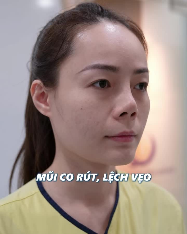 HÀNH TRÌNH "HỒI SINH" NHỮNG CA MŨI HỎNG CỰC KHÓ