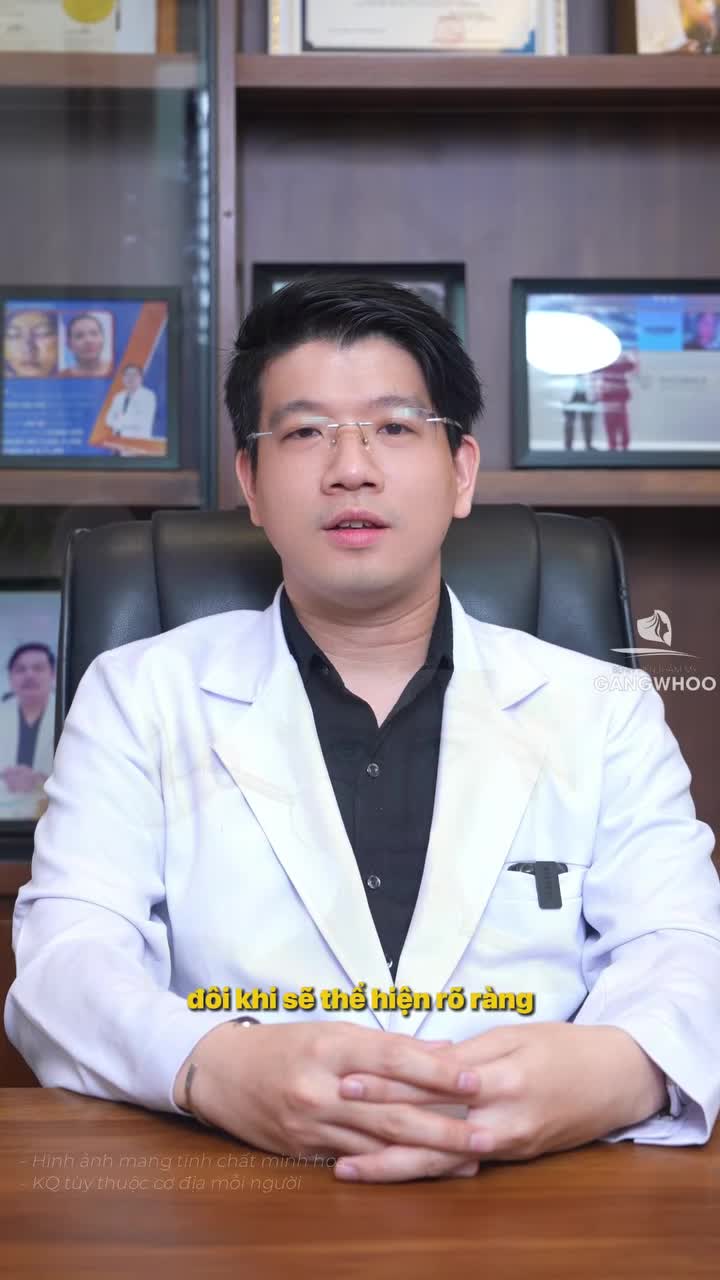 Có nên nhăn mặt để test hiệu quả của botox hay không?