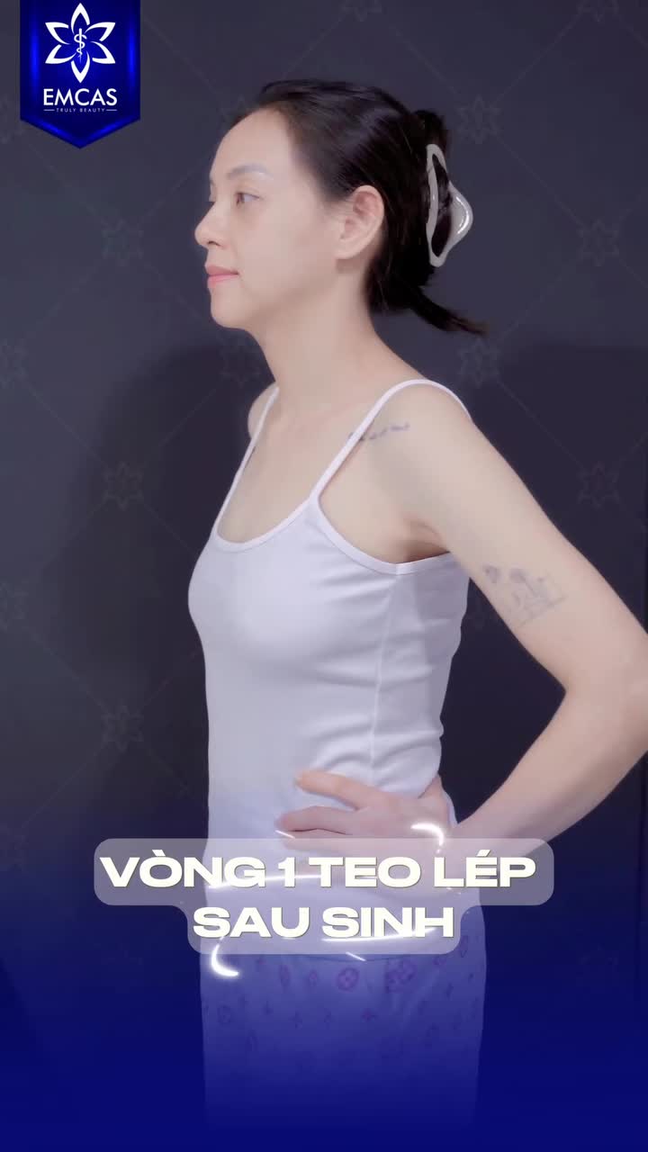Mạnh dạn đầu tư túi Ergonomix 2 như khách EMCAS các nàng ơi. Túi về form nhanh chóng - Mềm mại như mô thật - Đường mổ cực nhỏ