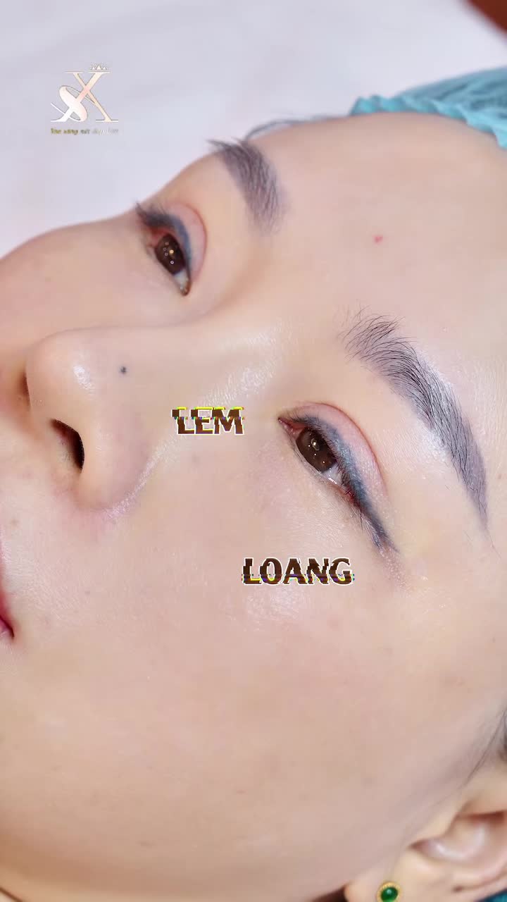 LOẠI BỎ MỰC XĂM MÍ - MẮT ĐẸP HẾT Ý