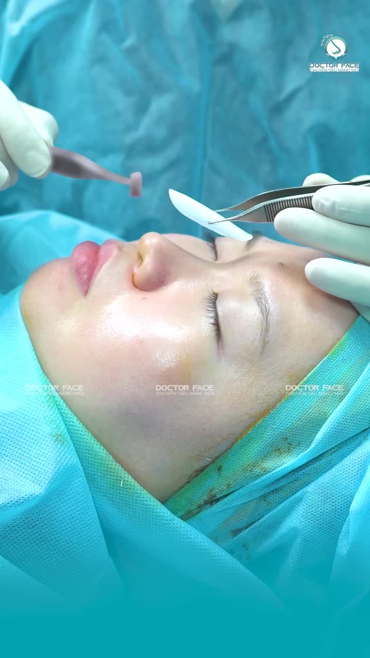 Khách hàng đã có lựa chọn của riêng mình. Vậy bác sĩ sẽ điều chỉnh và thiết kế dáng mũi như thế nào để phù hợp với gương mặt?