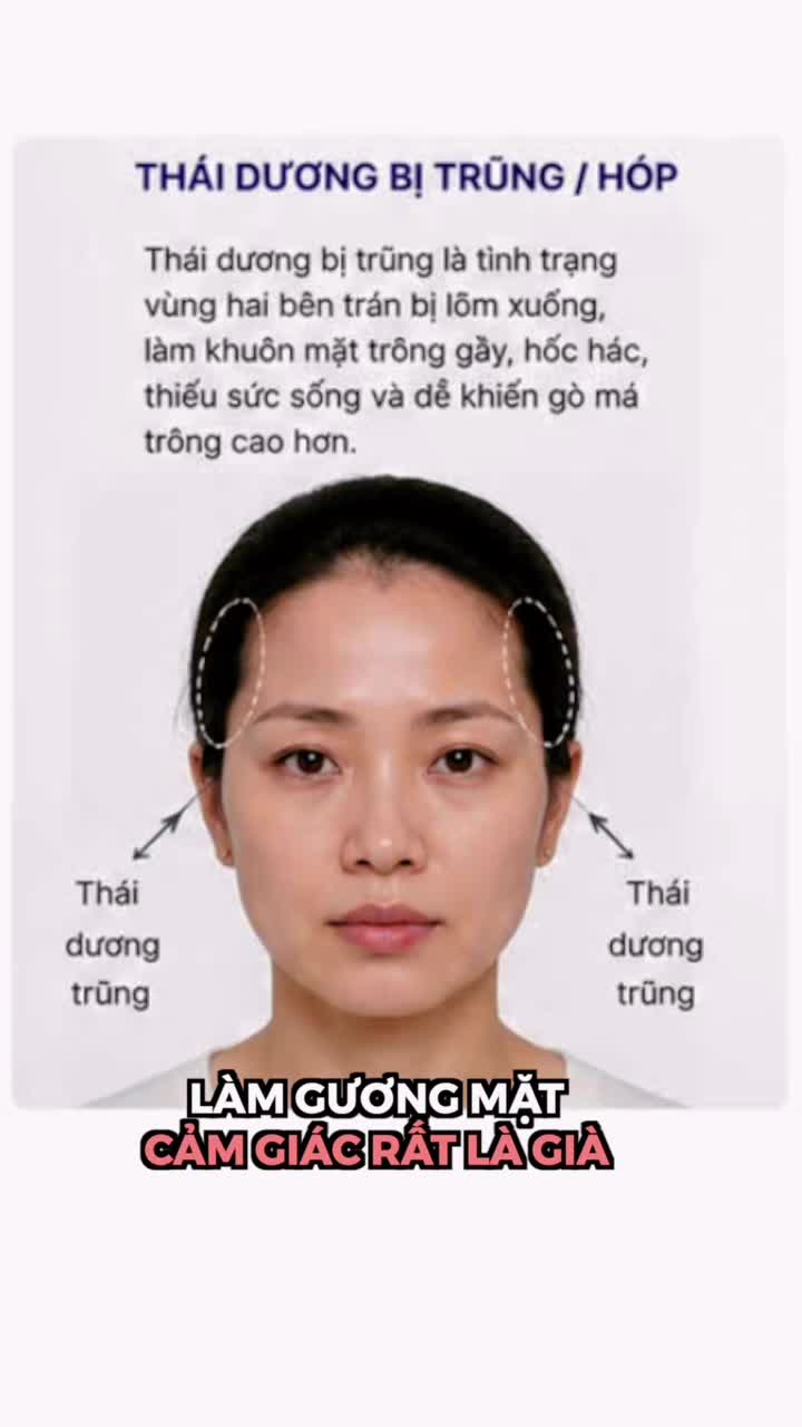 CẤY MỠ THÁI DƯƠNG LỰA CHỌN AN TOÀN HAY ĐÁNH ĐỔI RỦI RO??