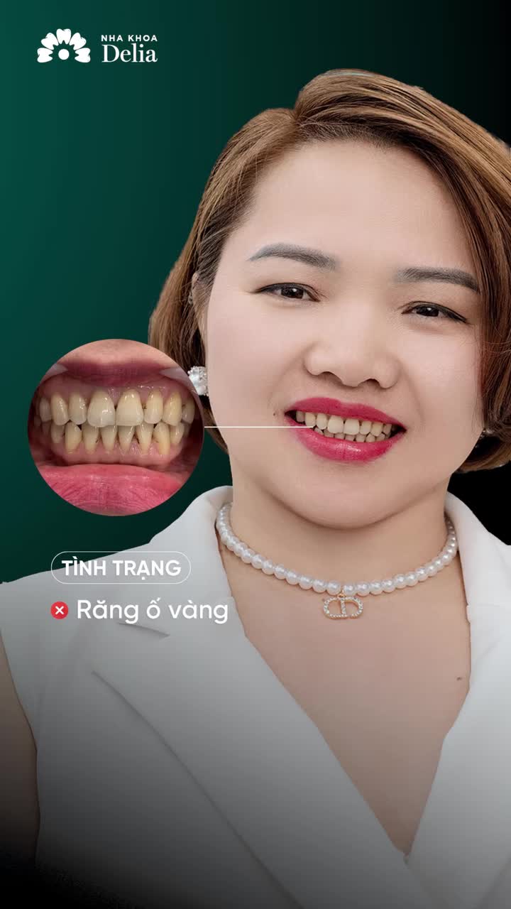 Doanh nhân ở Bắc Ninh khẳng định: "Muốn làm răng sứ bền đẹp đến Delia Hà Nội!"