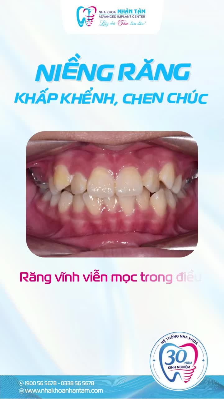 Ở tuổi dậy thì, con bắt đầu quan tâm nhiều hơn đến ngoại hình và nụ cười của mình.