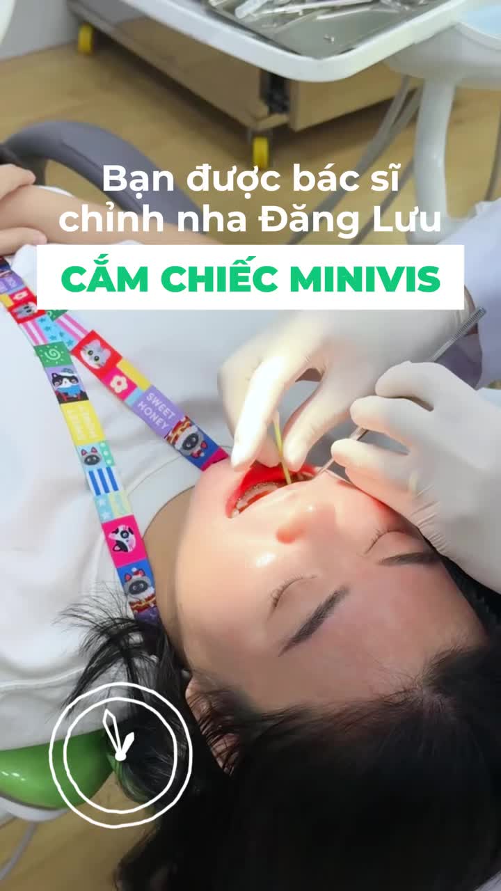 Cận cảnh quá trình cắm minivis chỉnh nha tại Nha Khoa Đăng Lưu
