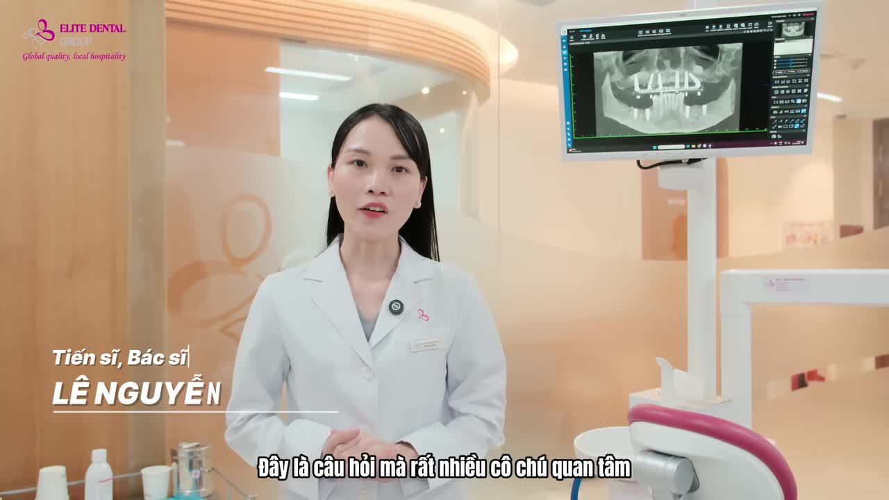 TRỒNG RĂNG IMPLANT TOÀN HÀM SAU BAO LÂU SẼ CÓ RĂNG?