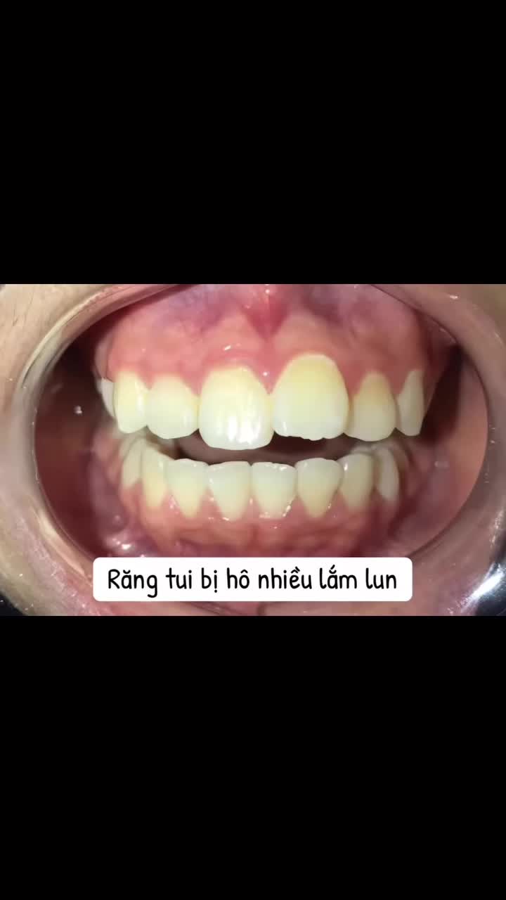 Thế nào là dậy thì thành công?