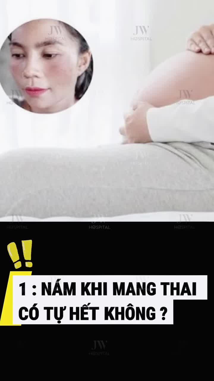 BÁC SĨ SKINCARE JW CHÍNH THỨC GIẢI ĐÁP TOP 3 CÂU HỎI VỀ TRỊ NÁM MÀ HẦU HẾT CHỊ EM ĐỀU MUỐN BIẾT