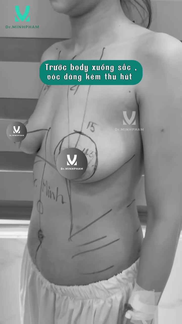 ĐẾN VỚI DR. MINH PHẠM – VÓC DÁNG THĂNG HẠNG