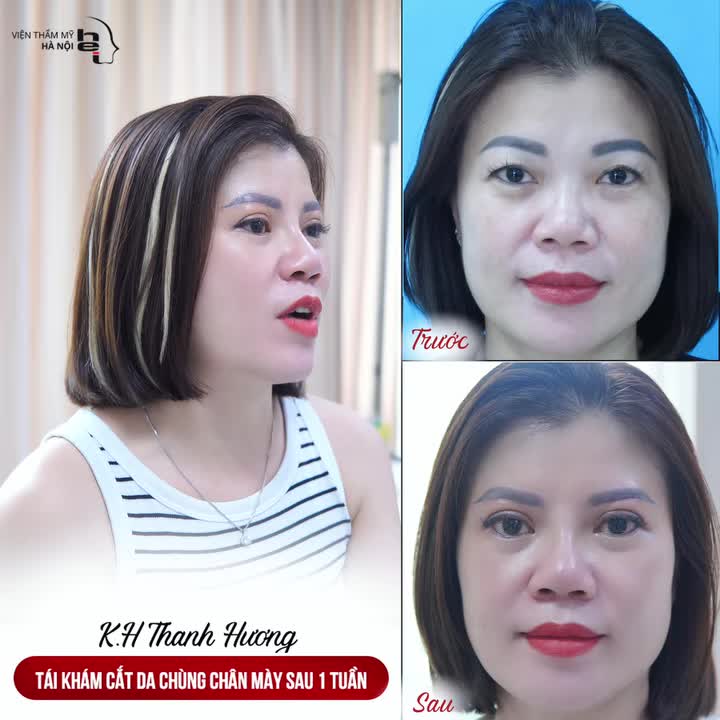 DA CHÙNG MÍ MẮT KHIẾN BẠN GIÀ HƠN TUỔI?