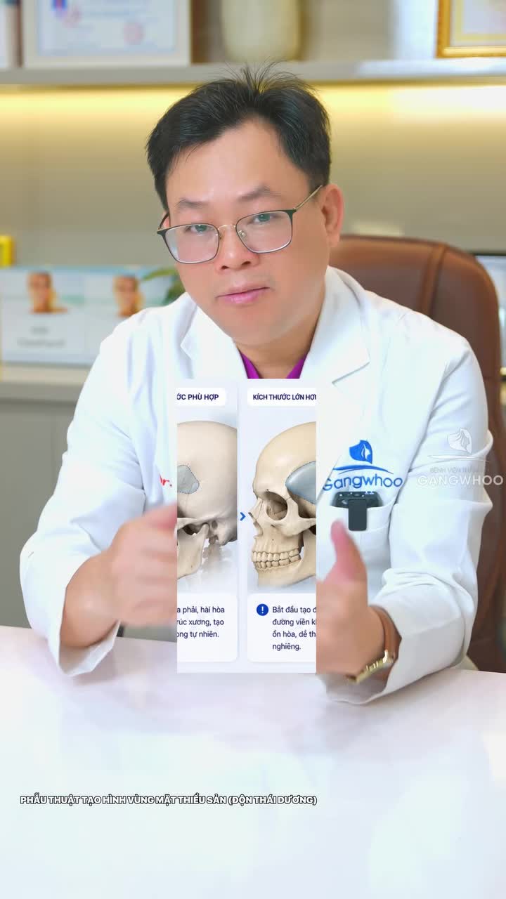 Có phải độn thái dương càng đầy thì càng đẹp và trẻ không?