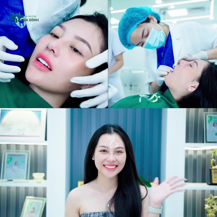 KHÁCH HÀNG TẠI NHA KHOA GIA ĐÌNH LÀM RĂNG SỨ SAU NHIỀU NĂM ĂN NHAI VẪN TỐT