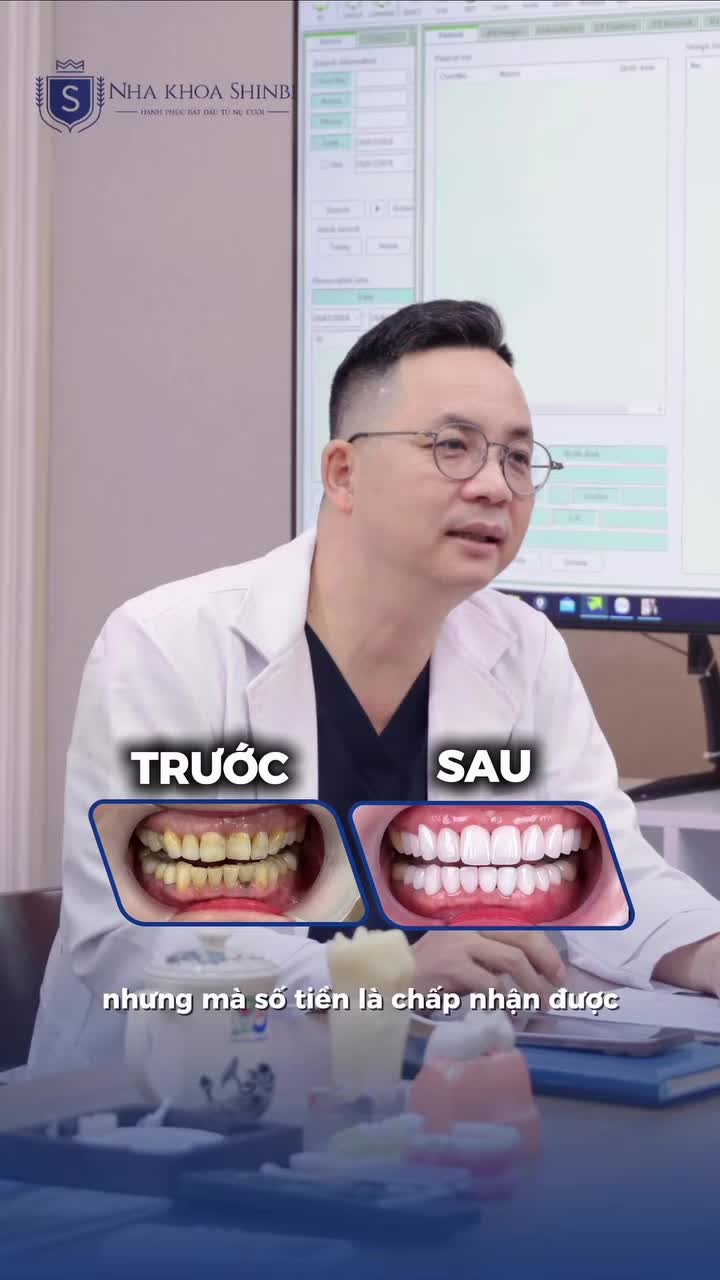 Làm 28 răng sứ 80 triệu không hề đắt nếu chọn đúng nơi uy tín.